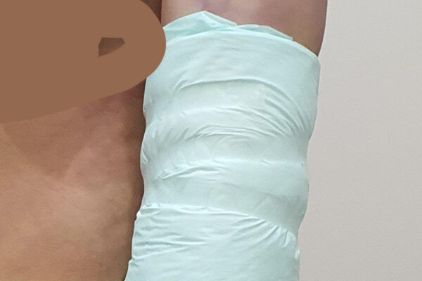 Day of Surgery