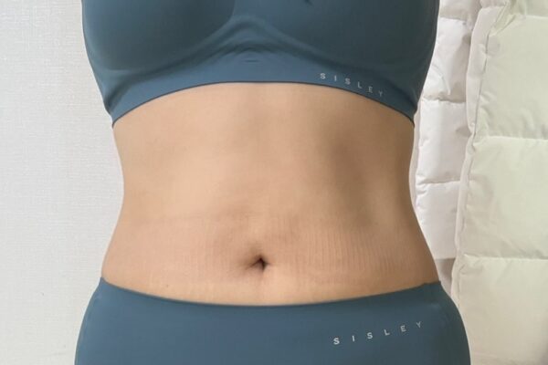 Month 1
